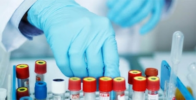 Capacitación en Hemostática y Trastornos de la Coagulación